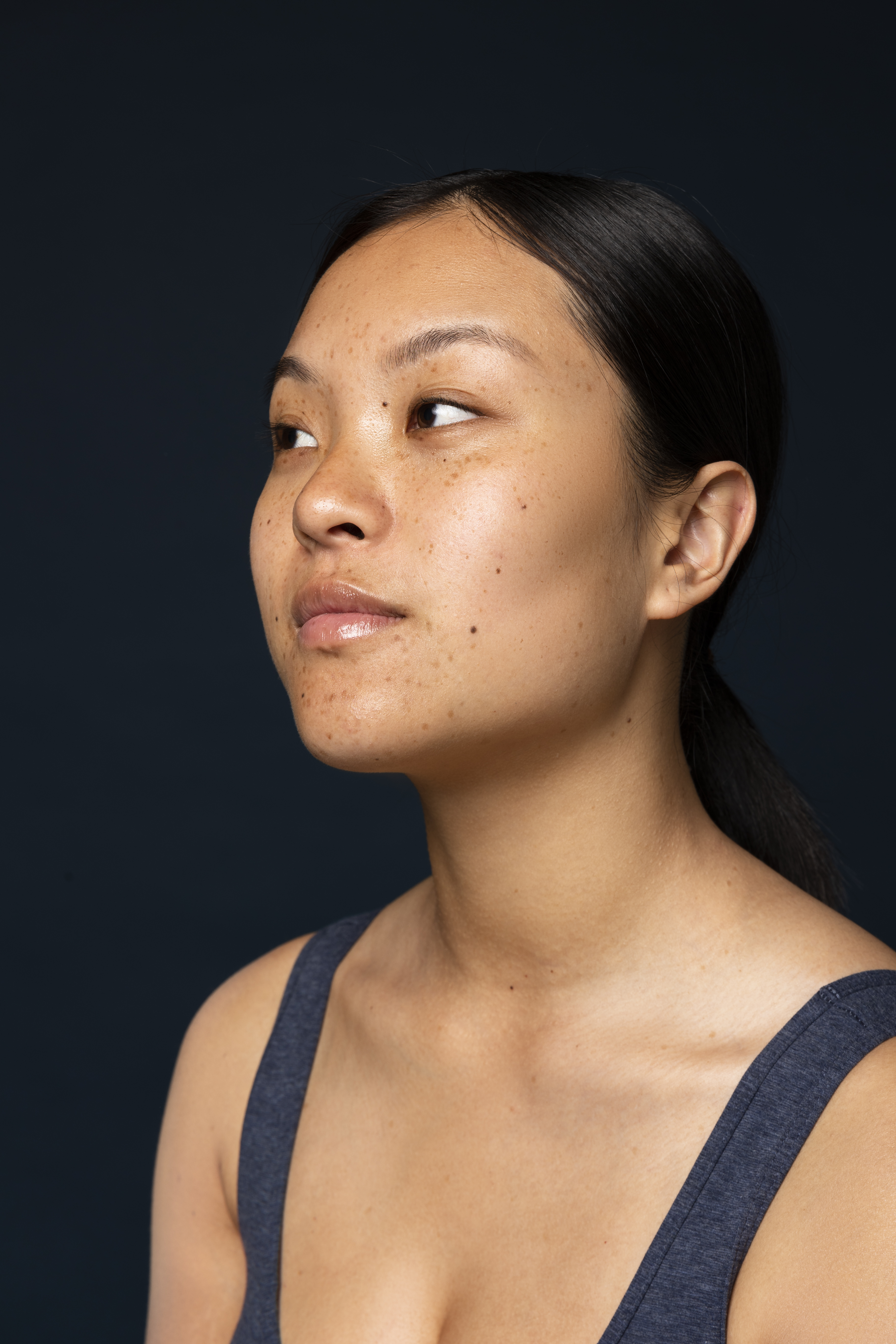 Acne & Pigmentation Management