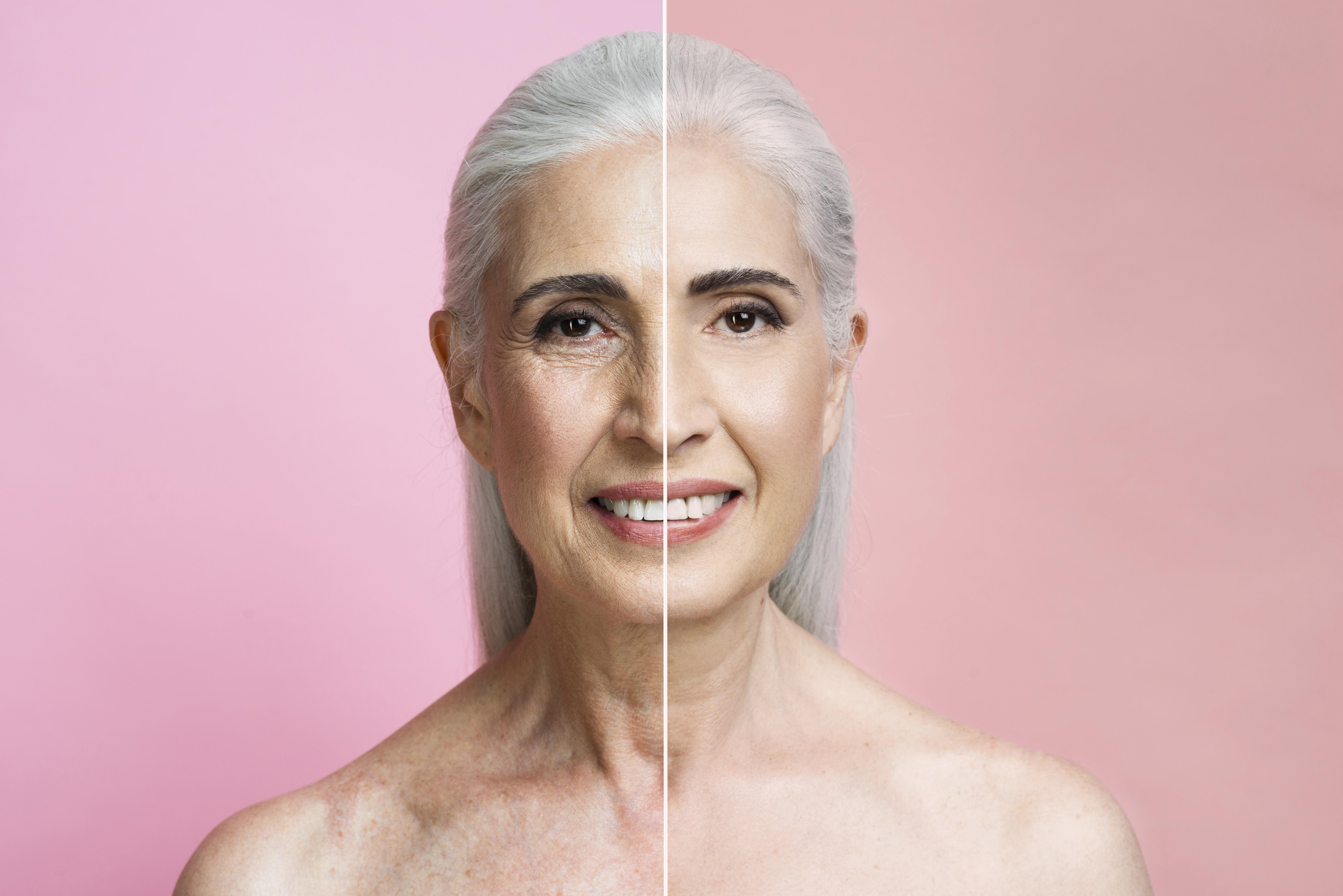 Anti-Aging Solutions: Natural Ways to Maintain Youthful Skin