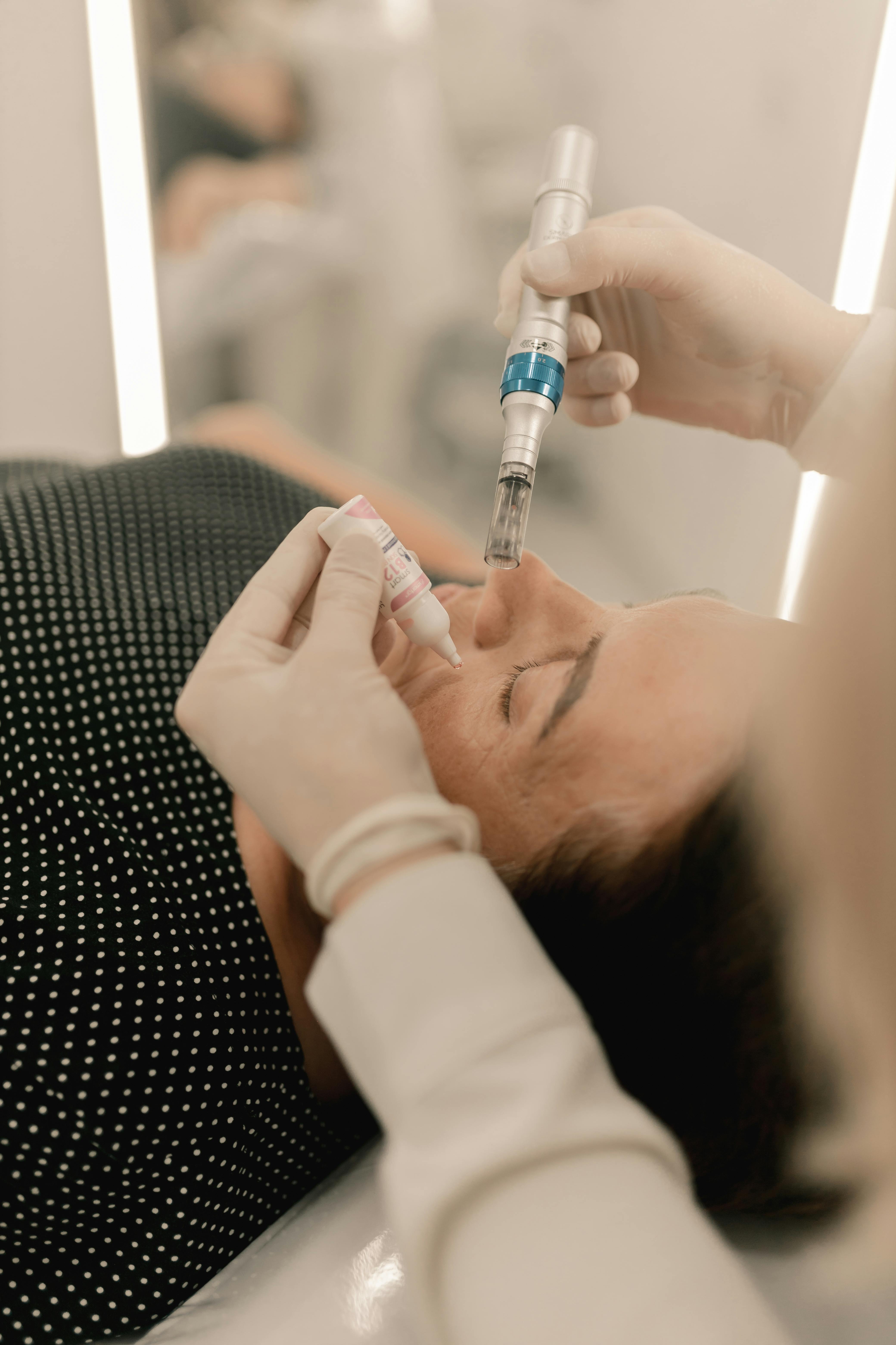 Microneedling with PRP Treatment